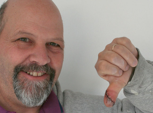Thumbs down.jpg